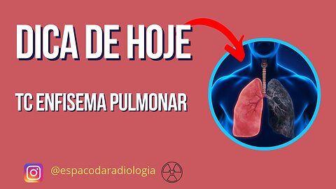 [ENFISEMA] Tomografia de tórax