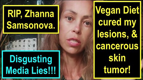 Zhanna Samonova drank no water for 6 years!!!! Vegan diet cured my lesions, & cancerous skin tumor!