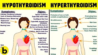 Thyroid Symptoms In Women: Signs, Causes & Treatment