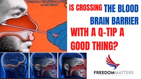 Is Crossing the Blood Brain Barrier with a Q-Tip a Good Thing?