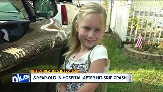 Police are looking for hit-and-run driver who injured an 8-year-old in Stark County