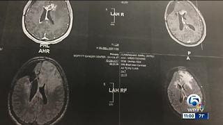 Local glioblastoma patients fear something local could be causing their illness, want investigation