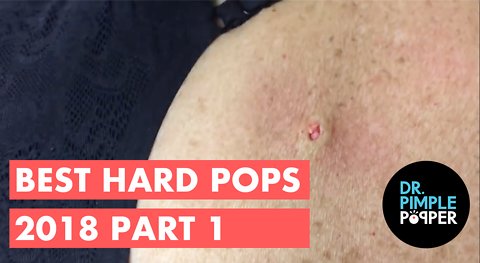 Best of Hardpops Part 1 2015 Revisited 2018!