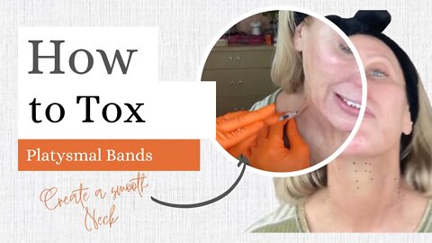 DIY Botox Platysmal Bands for a Smoother Neck -Wondertox @Estaderma SASSY15