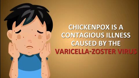 How To CURE Chicken Pox In Babies and Toddlers?