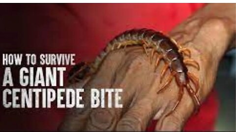 HOW TO SURVIVE A GIANT CENTIPEDE BITE | Tech and Science |