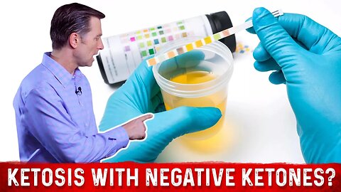 Can You Be in Ketosis Despite No Ketones in the Urine? – Dr. Berg