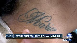 tattoo removal helps domestic violence victim move on