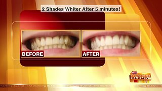 Spring into a Whiter Smile this Season!