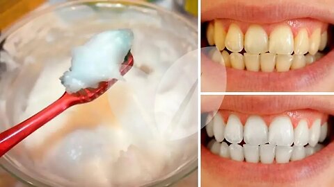 Em apenas 3 MINUTOS clareie seus Dentes em casa de forma Natural