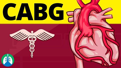 CABG (Coronary Artery Bypass Graft) Medical Definition