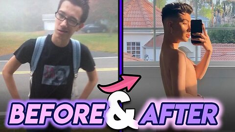 James Charles | Before and After | Butt Implants ? Plastic Surgery Rumours & more