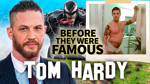 Tom Hardy | Before They Were Famous | From Serious Addictions To Venom 2