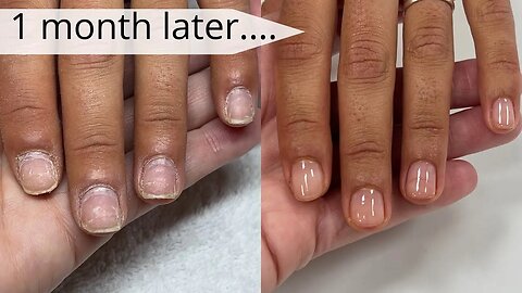 UPDATE!! Growing out bitten and damaged nails [Manicure #4] Watch Me Work