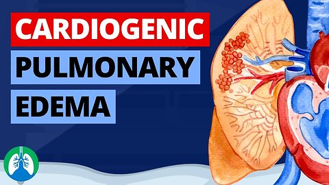 Cardiogenic Pulmonary Edema (Medical Definition) | Quick Explainer Video