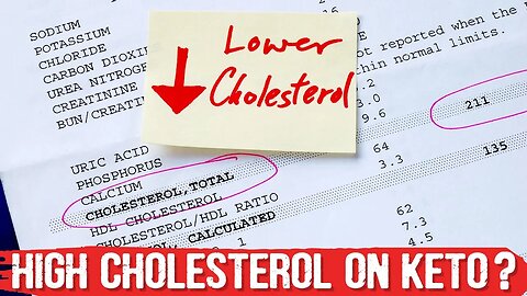 Stop Worrying About LDL & High Cholesterol on Keto Diet – Dr. Berg