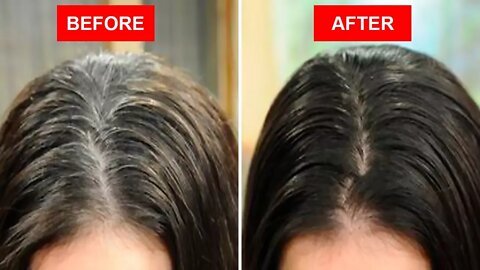 Home Remedies to Turn White Hair Black Without Chemical Dyes