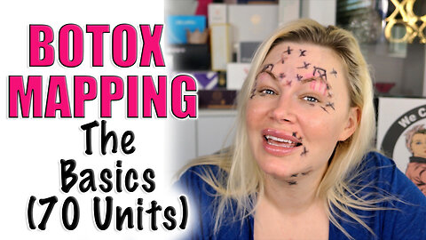 My Botox Mapping: The Basics (70 Units DIY) | Code Jessica10 saves you Money at All Approved Vendors