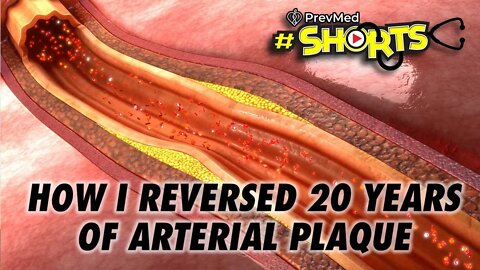 #SHORTS: How I Reversed 20 years of Arterial Plaque