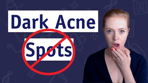 How To Get Rid Of Dark Spots Now 🚫