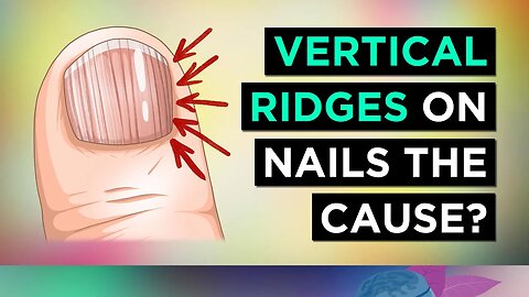 The REAL Causes of VERTICAL RIDGES On Your Nails