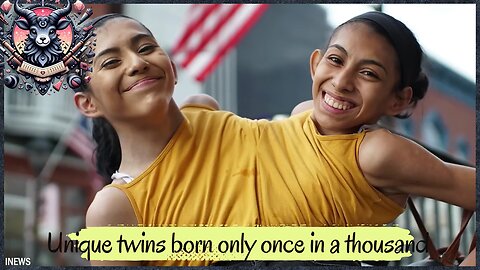 Unique twins born only once in a thousand years