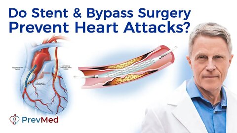 Do Stent & Bypass Surgery Prevent Heart Attacks?