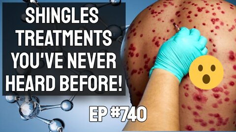 How To Get Rid of Shingles Naturally