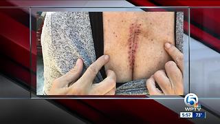 West Palm Beach stabbing victim tells her story of survival