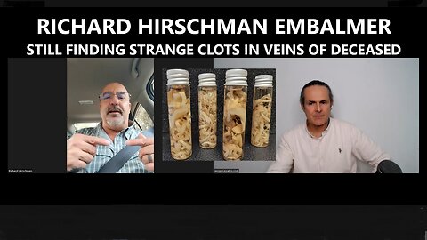 Richard Hirschman Embalmer - Still Finding Strange Clots in Veins of Deceased