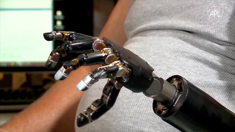 $120 Million Prosthetic Arm