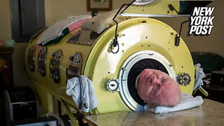 'Polio Paul' Alexander, who spent 70 years inside iron lung, dead at 78