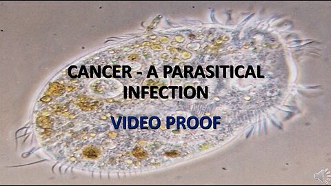 Irrefutable proof that Cancer is caused by a parasitic infection.