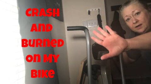 Crash and Burned on My Bike