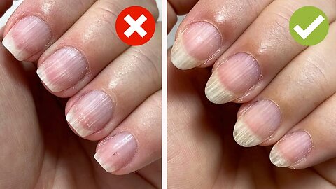 Oval nail shape correction (how one of the viewers corrected the shape of her nails!)