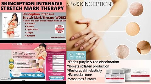 Skinception Intensive Stretch Mark Therapy - Intensive Care of Stretch Marks Skinception #skincare