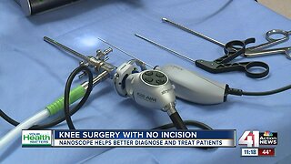 Your Health Matters: Oct. 24: Knee surgery with no incision