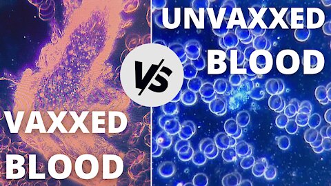 VAXXED BLOOD VS UNVAXXED BLOOD