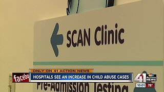 Hospitals see an increase in child abuse cases