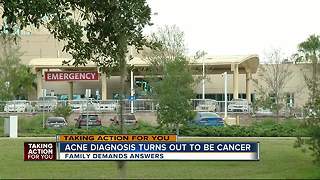 ER doctor misdiagnosed cancer as teen acne