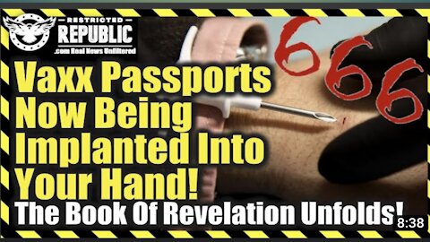 Yikes Vaccine Passports Now Being Implanted Into Your Hand The Book Of Revelation Unfolds...