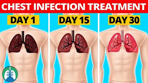 7 Natural Chest Infection Treatments (Home Remedies)
