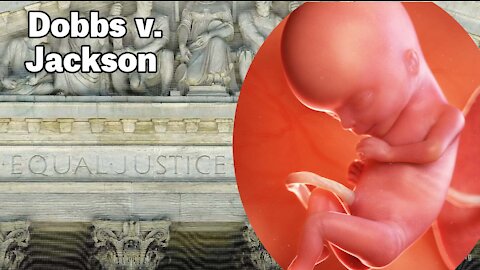 The Supreme Court Must Uphold Abortion Limits