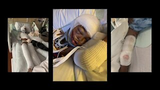 11-year-old has fifth surgery in two weeks after being hit, dragged by SUV while bike riding