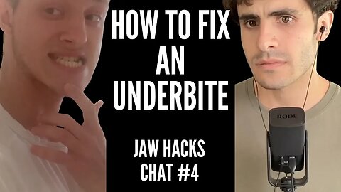 Chat #4 - Fix Underbite with Surgery or MSE + Facemask?