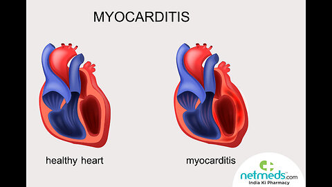 Myocarditis No longer Rare. but only 1%