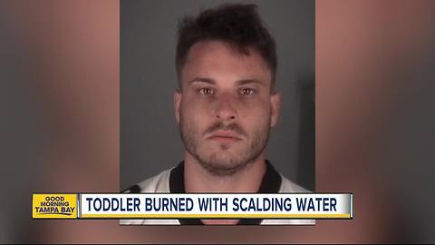 Dade City man admits to pouring scalding hot water on toddler