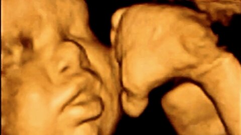 Incredible 3D & 4D Scan of what unborn babies do in the womb