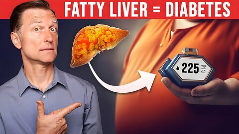 Revealing the Shocking Connection: Fatty Liver and Diabetes