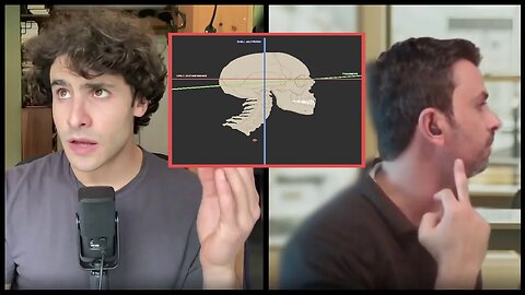 Small Jaws, Neck Posture, Nerve Pain, and Starecta